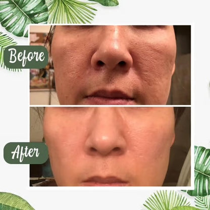 Green tea mask ~ Cleanse, tighten, and glow in  just minutes.