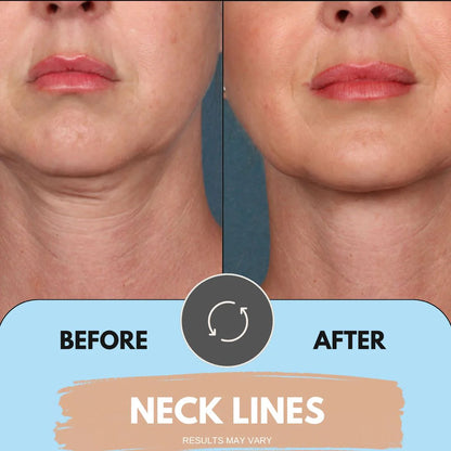 Face Lift Sculptor ~ Chin & Neck Tightening Light Therapy