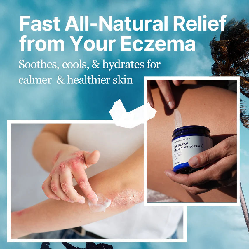 Healing Cream ~ Soothing relief for eczema and psoriasis in just days