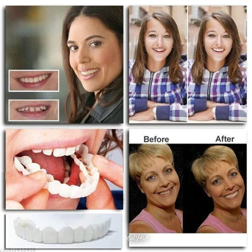 Snap-on veneers (Upper & Lower Set) ~ Instantly transform your smile with ease