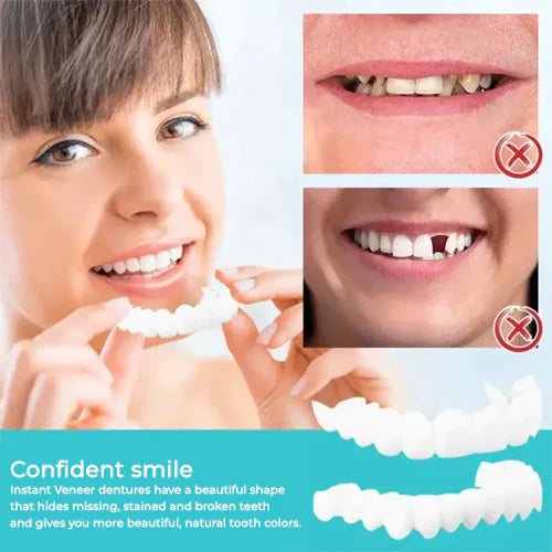 Snap-on veneers (Upper & Lower Set) ~ Instantly transform your smile with ease