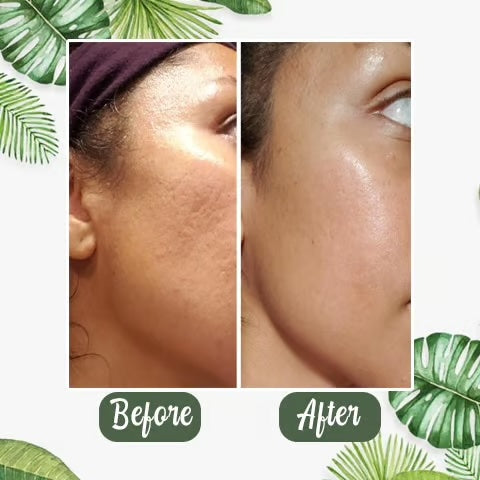 Green tea mask ~ Cleanse, tighten, and glow in  just minutes.