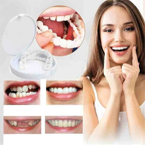 Snap-on veneers (Upper & Lower Set) ~ Instantly transform your smile with ease