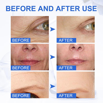 Botox Stock Solution Facial Serum ~ Smooth, youthful skin in every drop.