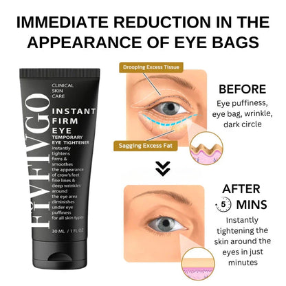 Instant Eye Tightener ~ Erase wrinkles and refresh eyes instantly.