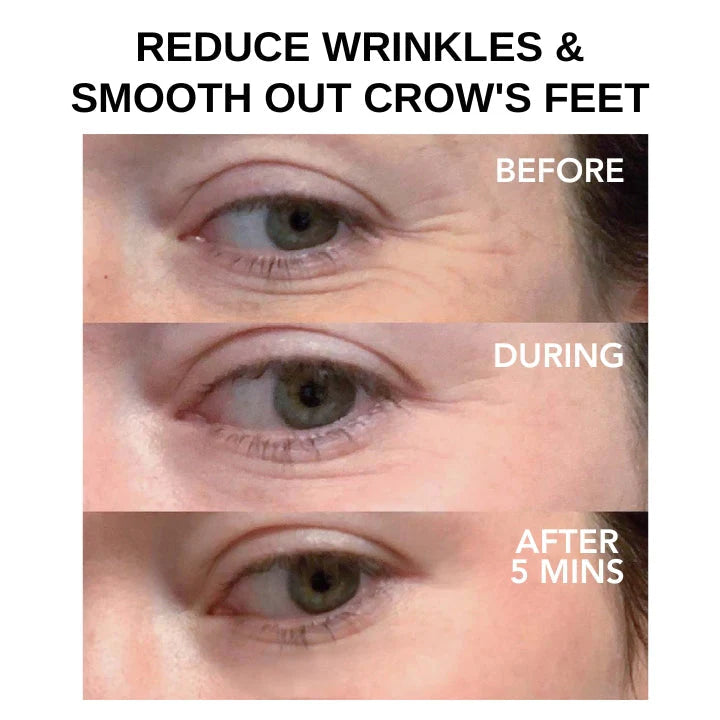 Instant Eye Tightener ~ Erase wrinkles and refresh eyes instantly.