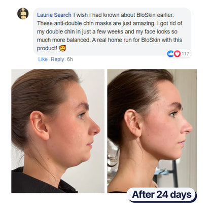 Double Chin Mask ~ Achieve a slimmer jawline and reduced chin sag in weeks