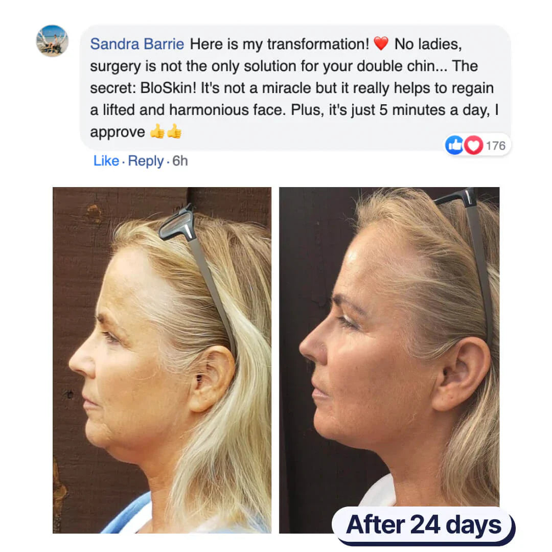 Double Chin Mask ~ Achieve a slimmer jawline and reduced chin sag in weeks