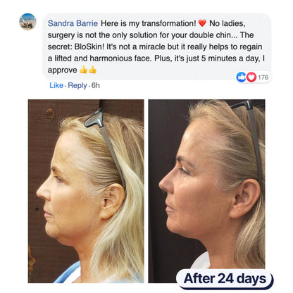 Double Chin Mask ~ Achieve a slimmer jawline and reduced chin sag in weeks