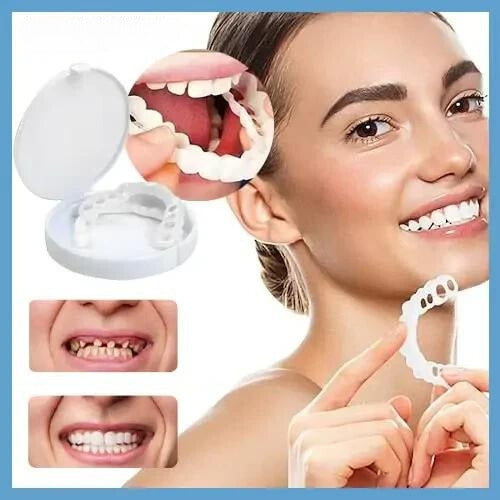 Snap-on veneers (Upper & Lower Set) ~ Instantly transform your smile with ease-