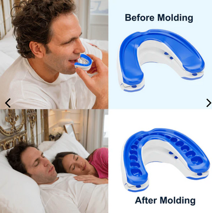 Anti-snoring mouthpiece  - Treat snoring and get restful sleep overnight