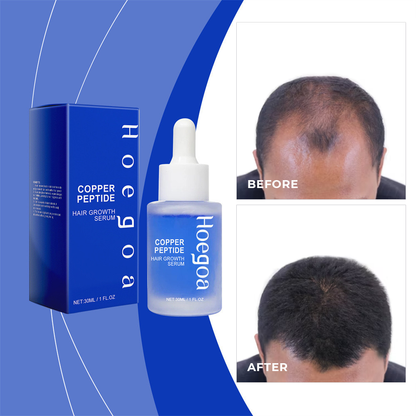 Advanced Copper Peptide Hair Regrowth Formula