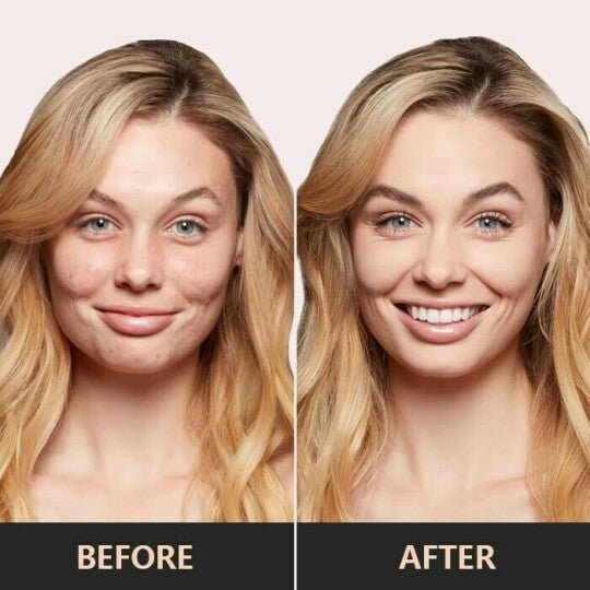 Side-by-side comparison showing a woman before and after a facial transformation.