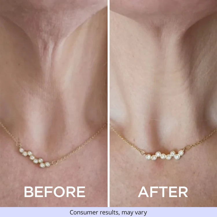 Neck Cream ~ Lift and firm in minutes