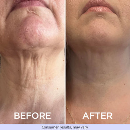 Neck Cream ~ Lift and firm in minutes