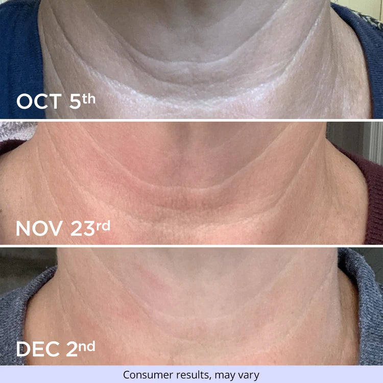 Neck Cream ~ Lift and firm in minutes